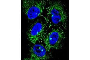 Confocal immunofluorescent analysis of ADH7 Antibody (C-Term) with NCI-H460 cell followed by Alexa Fluor® 488-conjugated goat anti-rabbit lgG (green). (ADH7 Antikörper  (C-Term))