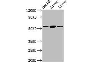 Western Blot Positive WB detected in: HepG2 whole cell lysate, Rat liver tissue, Mouse liver tissue All lanes: GPT antibody at 4. (ALT Antikörper  (AA 2-496))