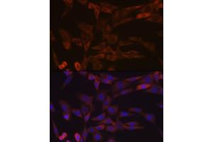 Immunofluorescence analysis of NIH-3T3 cells using Inhibin beta A (INHBA) (INHBA) Rabbit mAb (ABIN7267870) at dilution of 1:100 (40x lens). (INHBA Antikörper)