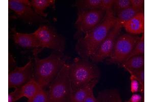 Immunofluorescence staining of methanol-fixed MCF cells using Phospho-ESR1-S167 antibody. (Estrogen Receptor alpha Antikörper  (pSer167))
