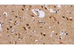Immunohistochemistry of paraffin-embedded Human brain using IL19 Polyclonal Antibody at dilution of 1:40