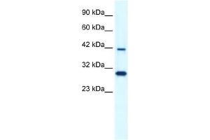 PREB antibody used at 1.