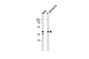 Western blot analysis of lysates from Hela cell line and human placenta tissue lysate (from left to right), using IDH3B Antibody at 1:1000 at each lane. (IDH3B Antikörper  (N-Term))