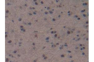 DAB staining on IHC-P; Samples: Mouse Brain Tissue (NPPC Antikörper  (AA 30-126))