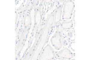 Immunohistochemistry of paraffin-embedded Human kidney (negative control sample) using CR2/CD21 Rabbit mAb (ABIN1678995, ABIN3015431, ABIN3015432 and ABIN7101406) at dilution of 1:200 (40x lens). (CD21 Antikörper)