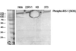 Western Blot (WB) analysis of specific cells using Phospho-IRS-1 (S636) Polyclonal Antibody. (IRS1 Antikörper  (pSer636))