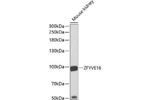 Western blot analysis of extracts of mouse kidney, using ZFYVE16 antibody (ABIN6129169, ABIN6150439, ABIN6150441 and ABIN6223717) at 1:1000 dilution. (ZFYVE16 Antikörper  (AA 1-280))