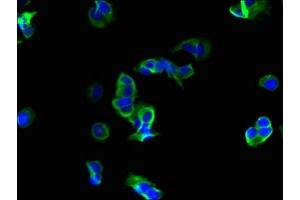 Immunofluorescent analysis of MCF-7 cells using ABIN7167429 at dilution of 1:100 and Alexa Fluor 488-congugated AffiniPure Goat Anti-Rabbit IgG(H+L) (ROMO1 Antikörper  (AA 45-79))
