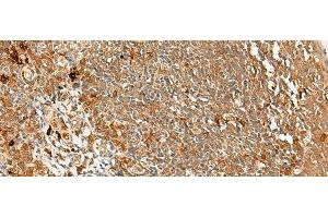 Immunohistochemistry of paraffin-embedded Human tonsil tissue using METTL17 Polyclonal Antibody at dilution of 1:60(x200) (METTL17 Antikörper)