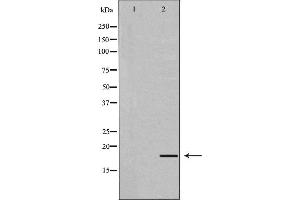 Western blot analysis of extracts of Mouse liver,using UBD antibody.