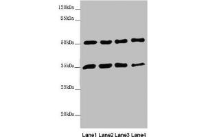 Western blot All lanes: MTX1 antibody at 3. (Metaxin 1 Antikörper  (AA 217-466))