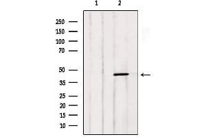 Western Blotting (WB) image for anti-Lymphotoxin beta Receptor (TNFR Superfamily, Member 3) (LTBR) (N-Term) antibody (ABIN6263023)