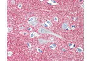 Anti-CD172A / SIRPA antibody IHC staining of human brain, cortex. (SIRPA Antikörper)