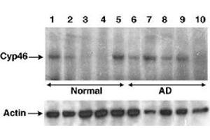 Western blot analysis of CYP46A1 in human brain lysates using CYP46A1 polyclonal antibody . (CYP46A1 Antikörper)