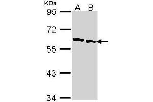 WB Image Sample (30 ug of whole cell lysate) A: Hep G2 , B: Raji 7. (CCT2 Antikörper)