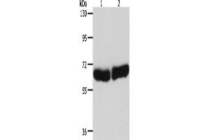 Western Blotting (WB) image for anti-Cytochrome P450, Family 1, Subfamily B, Polypeptide 1 (CYP1B1) antibody (ABIN2428023)