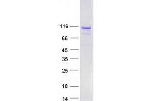 BEND3 Protein (Myc-DYKDDDDK Tag)