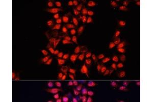Immunofluorescence analysis of HeLa cells using ADAM10 Polyclonal Antibody at dilution of 1:100. (ADAM10 Antikörper)