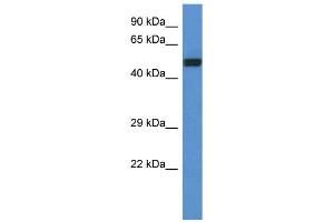 WB Suggested Anti-DLST Antibody Titration: 1.