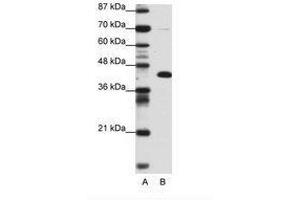 Image no. 1 for anti-Zinc Finger and BTB Domain Containing 25 (ZBTB25) (AA 181-230) antibody (ABIN6736153) (ZBTB25 Antikörper  (AA 181-230))