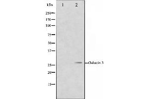 Western blot analysis on HeLa cell lysate using Galectin 3 Antibody,The lane on the left is treated with the antigen-specific peptide. (Galectin 3 Antikörper  (Internal Region))