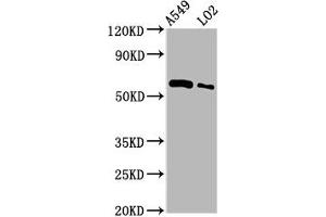 Western Blot Positive WB detected in: A549 whole cell lysate, LO2 whole cell lysate All lanes: PARP3 antibody at 3. (PARP3 Antikörper  (AA 1-240))