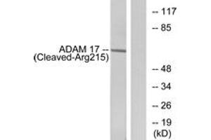 Western blot analysis of extracts from rat liver cells, using ADAM 17 (Cleaved-Arg215) Antibody. (ADAM17 Antikörper  (Cleaved-Arg215))
