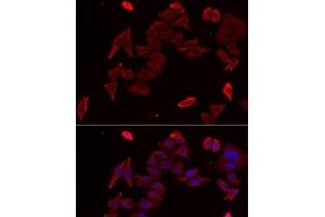 Immunofluorescence analysis of MCF7 cells using PDHX Polyclonal Antibody