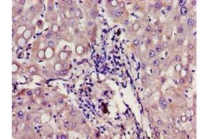 Immunohistochemistry of paraffin-embedded human liver tissue using ABIN7154509 at dilution of 1:100 (Growth Hormone Receptor Antikörper  (AA 19-184))
