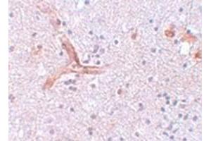 Immunohistochemical staining of human brain tissue with ZC3H12C polyclonal antibody  at 5 ug/mL dilution. (ZC3H12C Antikörper  (N-Term))
