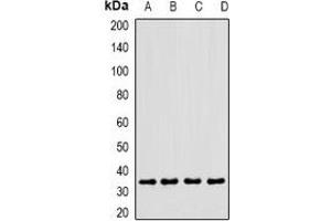 Western blot analysis of CLEC12A expression in MCF7 (A), U937 (B), mouse heart (C), rat liver (D) whole cell lysates. (CLEC12A Antikörper)