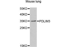 Western blot analysis of extracts of mouse lung, using PDLIM3 antibody (ABIN5975262) at 1/1000 dilution. (PDLIM3 Antikörper)