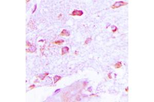 Immunohistochemical analysis of NSG2 staining in human brain formalin fixed paraffin embedded tissue section. (NSG2 Antikörper  (Center))