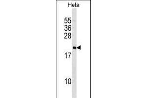 IP2 Antibody (N-term) (ABIN1539498 and ABIN2848464) western blot analysis in Hela cell line lysates (35 μg/lane). (PAIP2 Antikörper  (N-Term))