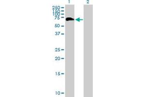 Western Blot analysis of PHF23 expression in transfected 293T cell line by PHF23 MaxPab polyclonal antibody. (PHF23 Antikörper  (AA 1-403))