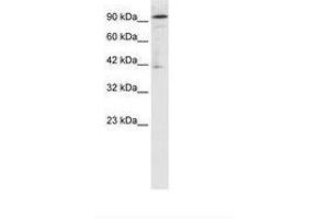 Image no. 1 for anti-OTU Domain Containing 7B (OTUD7B) (AA 559-608) antibody (ABIN202938) (OTUD7B Antikörper  (AA 559-608))