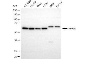 Western blotting analysis using KPNA1 antibody (ABIN7799158).