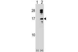 Western blot analysis of CLC (arrow) using rabbit polyclonal CLC Antibody (C-term) . (Galectin 10 Antikörper  (C-Term))