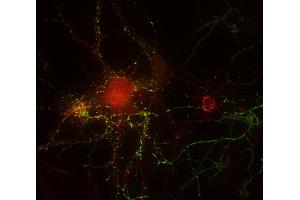Indirect immunostaining of PFA fixed rat hippocampus neurons with anti-ZnF 365 (dilution 1 : 500; red) and mouse anti-synapsin 1 (cat. (ZNF365 Antikörper  (AA 363-410))
