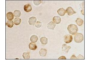 Immunocytochemistry staining of HeLa using AP30669PU-N at 10 μg/ml. (MTA2 Antikörper  (AA 652-668))