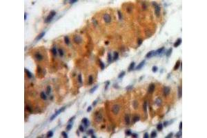 Used in DAB staining on fromalin fixed paraffin-embedded Stomach tissue (ALOX15 Antikörper  (AA 170-312))