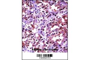 Immunohistochemistry (IHC) image for anti-Heat Shock Factor Protein 1 (HSF1) (AA 72-100), (N-Term) antibody (ABIN5535409)