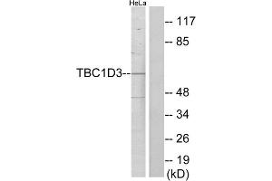 Western blot analysis of extracts from HeLa cells, using TBC1D3 antibody. (TBC1D3 Antikörper  (C-Term))