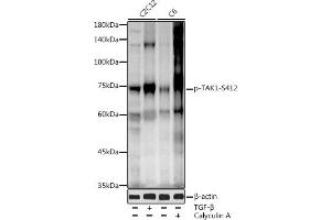 Western blot analysis of extracts of various cell lines, using Phospho-T-S412 antibody (ABIN3019511, ABIN3019512, ABIN3019513 and ABIN6225441) at 1:1000 dilution. (MAP3K7 Antikörper  (pSer412))