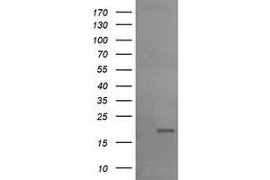Image no. 1 for anti-Ubiquitin-Conjugating Enzyme E2G 2 (UBE2G2) antibody (ABIN1501635) (UBE2G2 Antikörper)