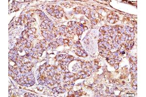 Immunohistochemistry (Paraffin-embedded Sections) (IHC (p)) image for anti-Microtubule-Associated Protein 1A (MAP1A) (AA 2651-2750) antibody (ABIN735308)