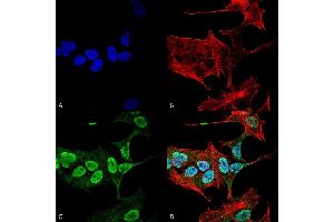 Immunocytochemistry/Immunofluorescence analysis using Mouse Anti-Alpha Synuclein Monoclonal Antibody, Clone 3C11 (ABIN5564065). (SNCA Antikörper  (FITC))