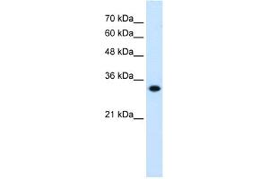 WB Suggested Anti-HMGCL Antibody Titration:  0. (HMGCL Antikörper  (C-Term))