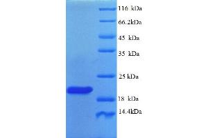 SDS-PAGE (SDS) image for Plexin A1 (PLXNA1) (AA 986-1152), (partial) protein (His tag) (ABIN5714496)