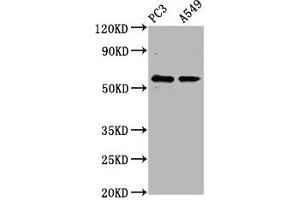 Western Blot Positive WB detected in: PC-3 whole cell lysate, A549 whole cell lysate All lanes: CYP1B1 antibody at 6. (CYP1B1 Antikörper  (AA 282-409))